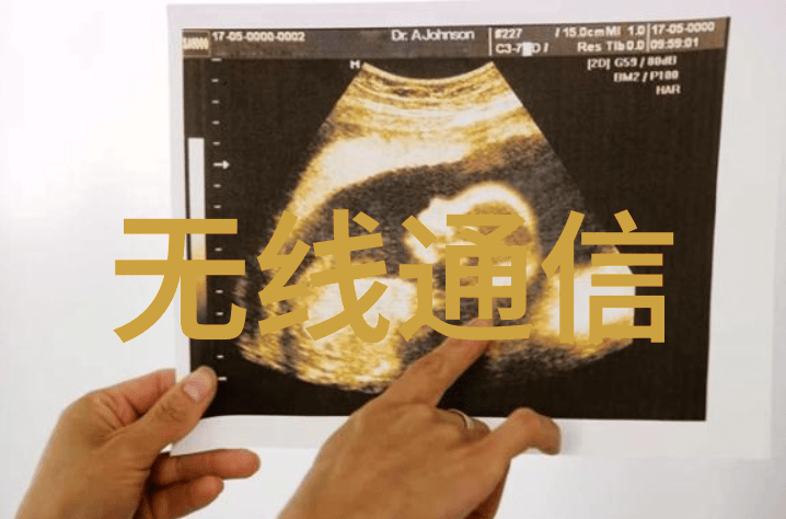 国家标准下的丝网规整填料织就精密的未来
